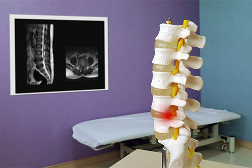 cirujano de columna cerca de mi