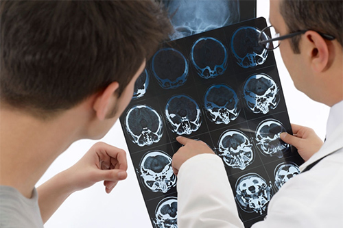 los mejores neurocirujanos en mexico