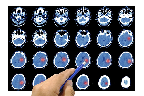 neurocirujano en gustavo a madero